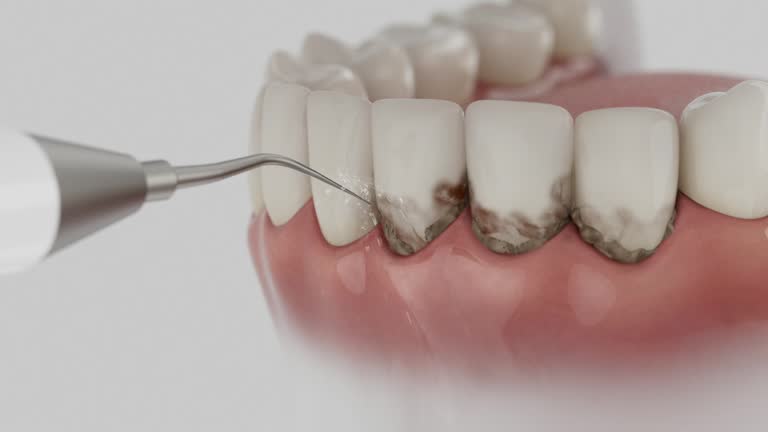 Reliable Dental contractor in Ruston, LA by Smile Center Dentistry